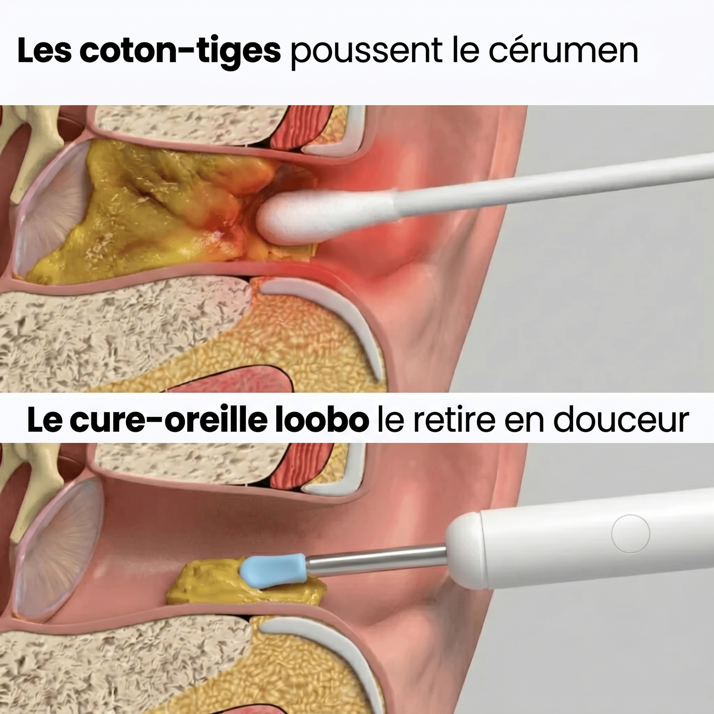 Cure-oreille Loobo 3