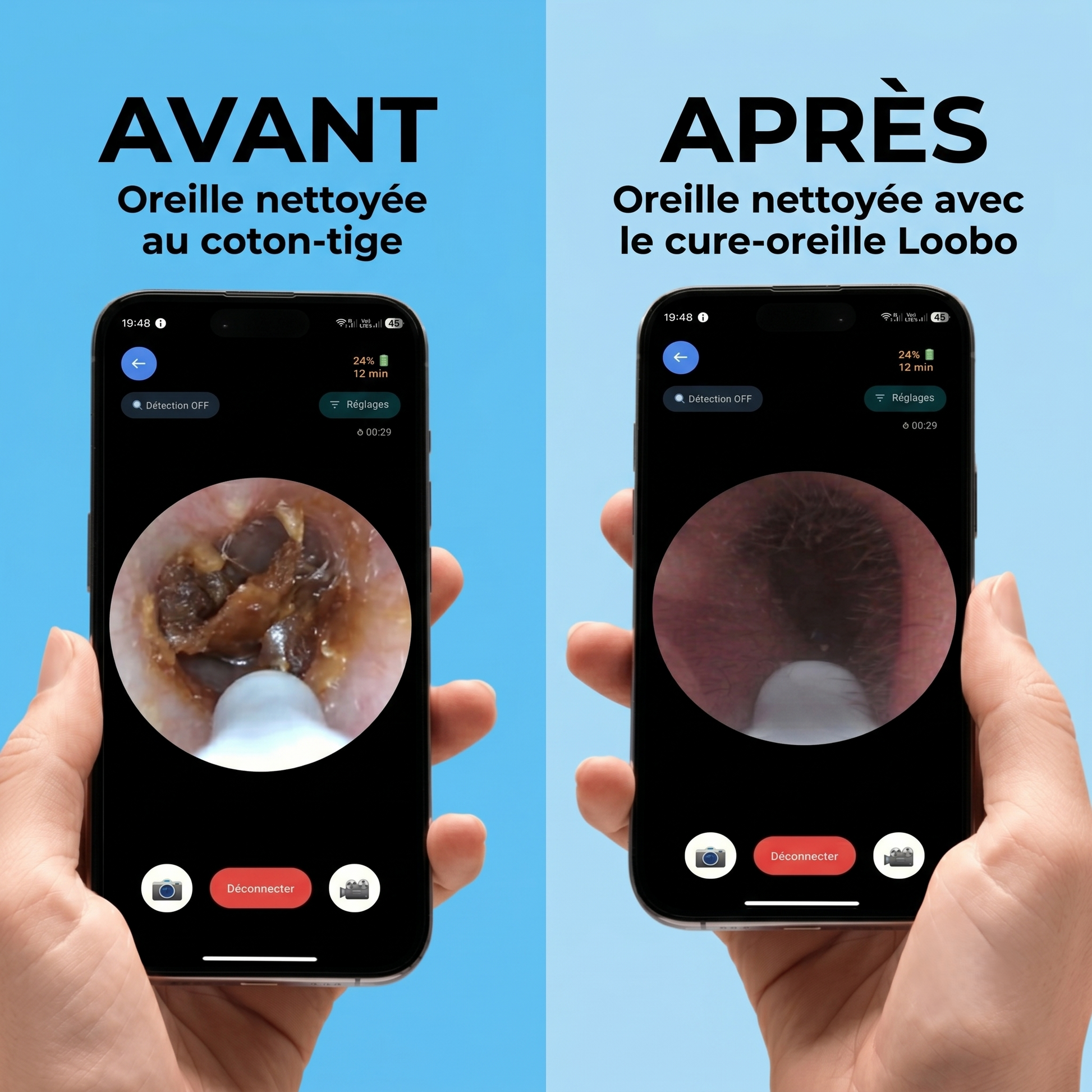 Cure-oreille Loobo 3