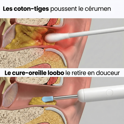 Cure-oreille Loobo 3