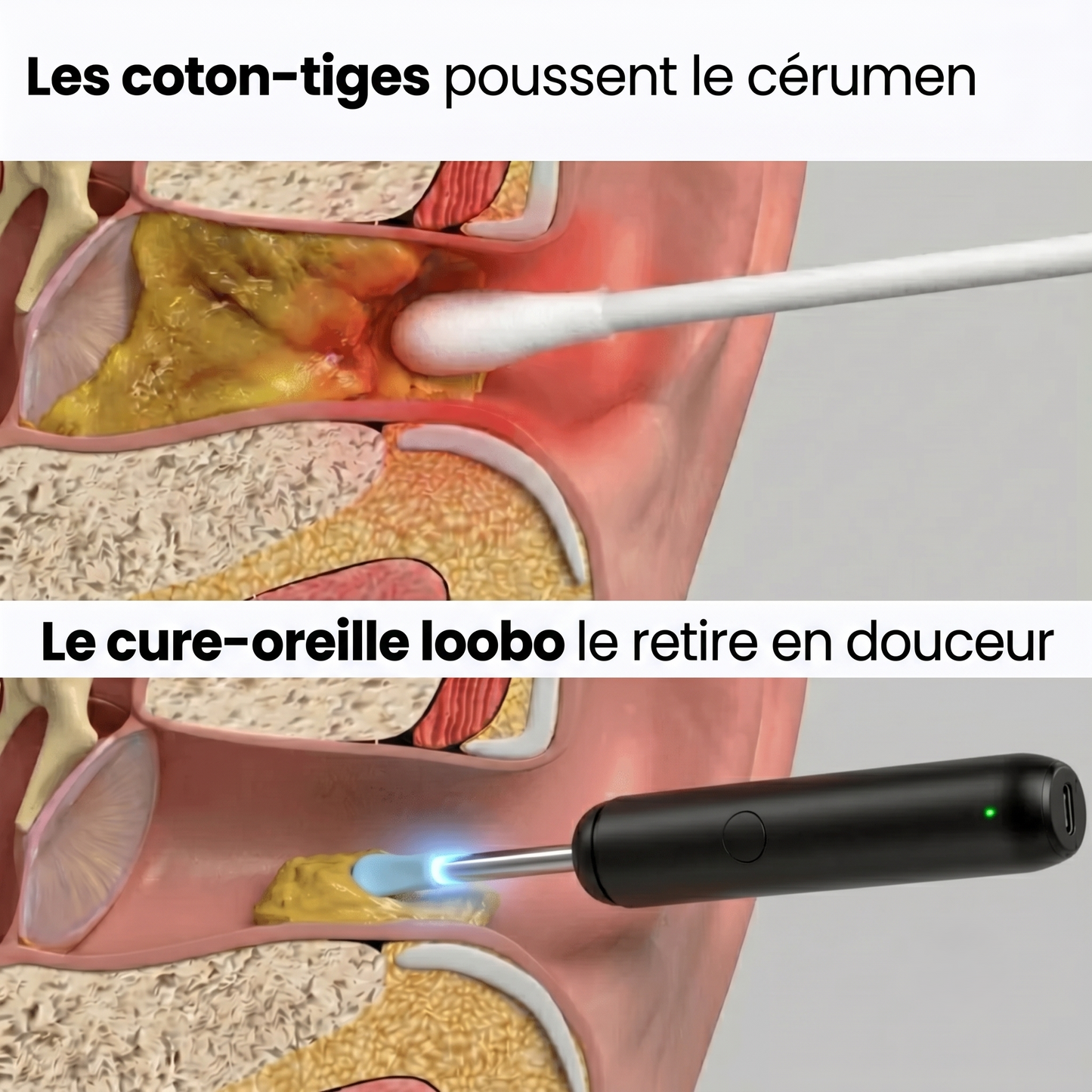 Cure-oreille Loobo 3
